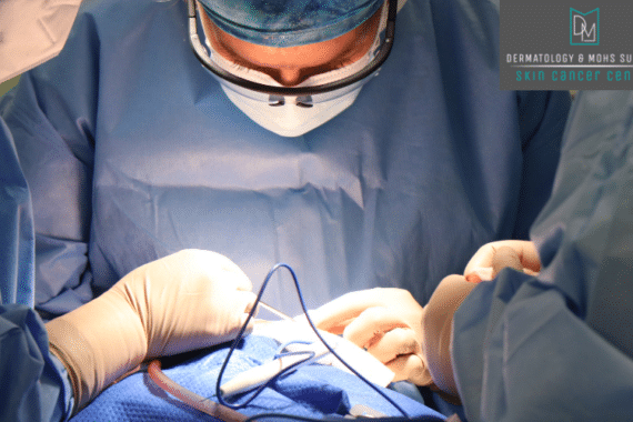 Mohs Micrographic Surgery in Springfield