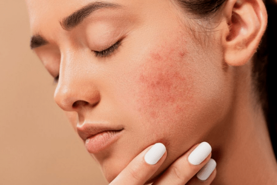 Common Questions About Medical Dermatology Answered