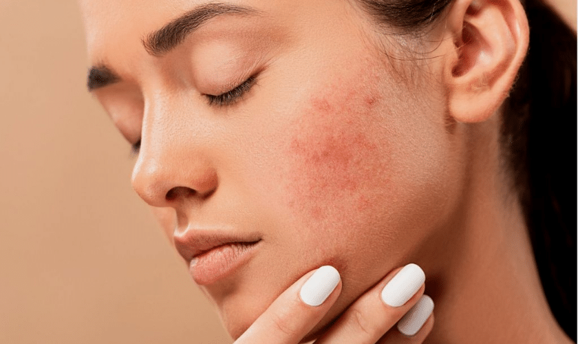 Common Questions About Medical Dermatology Answered
