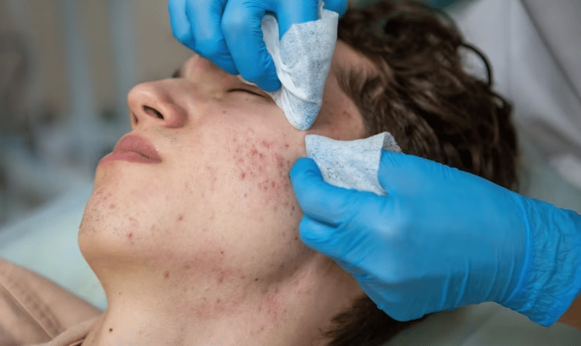 The Science Behind Scar Reduction in Cosmetic Dermatology