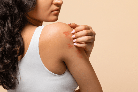 Understanding Common Skin Allergens and How to Avoid Them