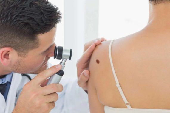 medical dermatology on sun safety and pre cancerous skin lesions