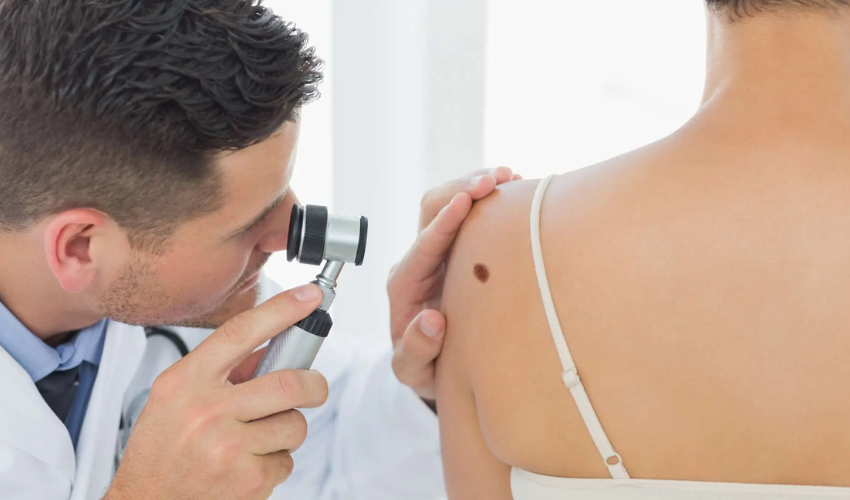 medical dermatology on sun safety and pre cancerous skin lesions