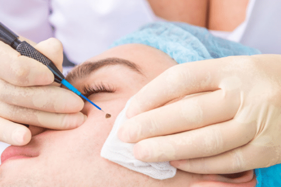 Transform Your Skin: Personalized Surgical Dermatology