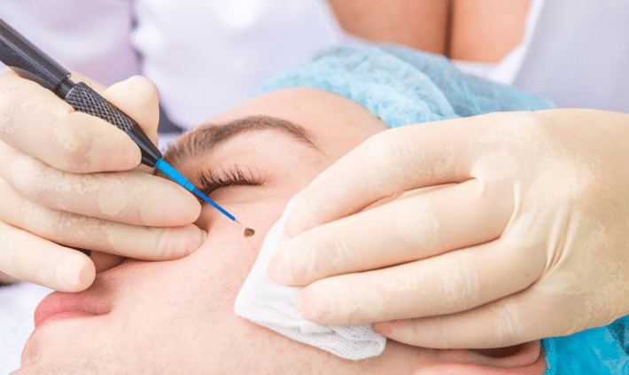 Transform Your Skin: Personalized Surgical Dermatology