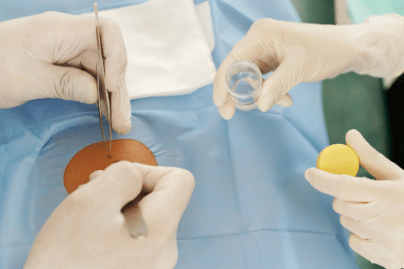 The Involvement of Surgical Dermatology in the Management of Skin Cancer