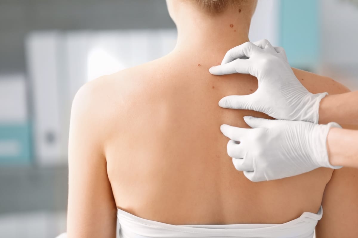 Surgical-Dermatology-in-Bloomington